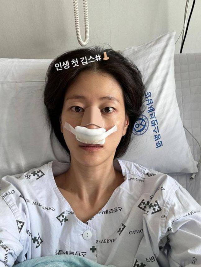 이현이, 축구에 다 걸었네…안면마비에 이번엔 코뼈 골절까지 "인생 첫 깁스"