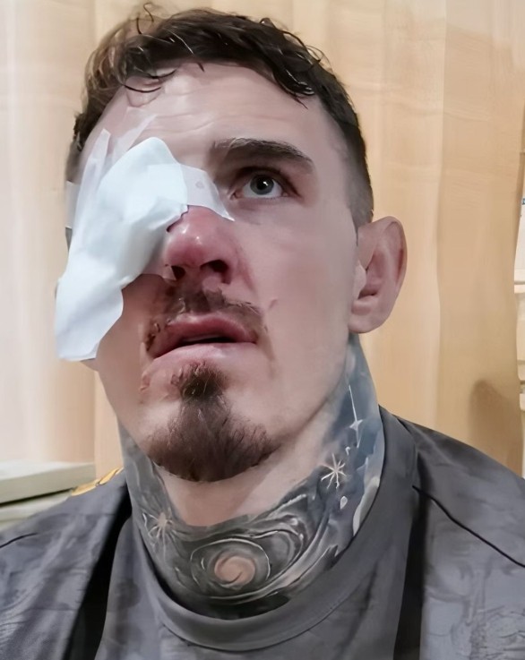 "앞이 안 보여"…UFC 챔피언 아스피날, 실명 위기!→존 존스 '독설 빌드업' 재가동 "안대 쓴 오리 녀석" 폭격