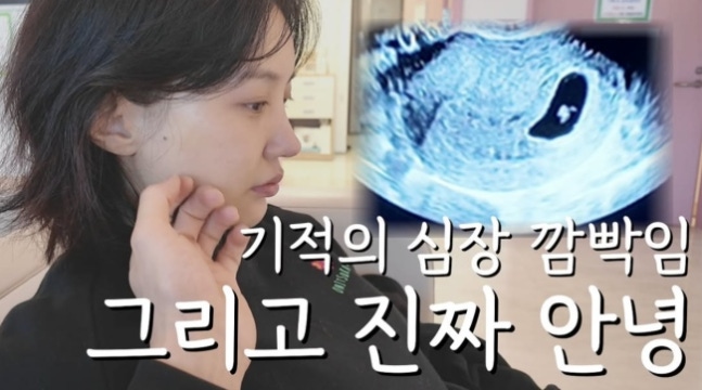 ▲ 출처| 로빈-김서연 부부 계정