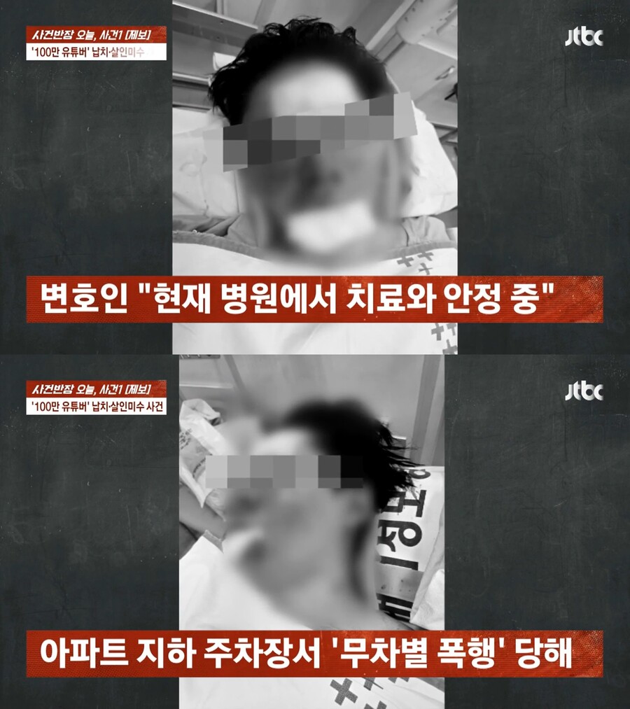 '납치·폭행 피해' 유튜버 수탉 "피범벅 처참, 이대로 죽나 싶었는데…수술 후 치료 중"[전문]