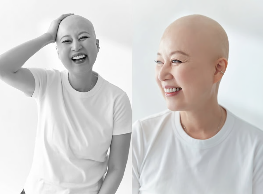 박미선, '민머리 프로필' 공개…"유방암, 완쾌라고 못해"[종합]