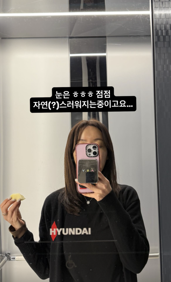 "점점 자연스러워지는 중" 안선영, 생애 첫 쌍커풀 수술 받았다