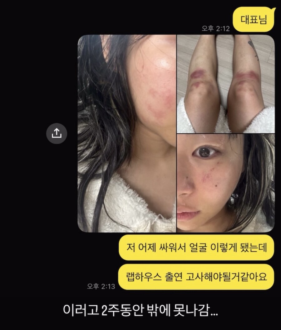 ▲ 재키와이. 출처| 재키와이 SNS