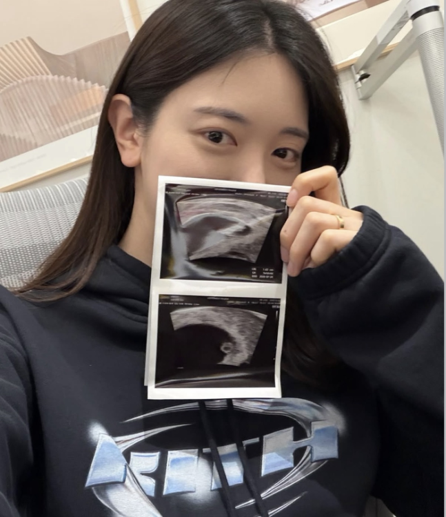 '얼짱' 유혜주, 남편도 눈물 흘린 둘째 임신…반응 터졌다 "뱀 태몽은 딸이라던데"