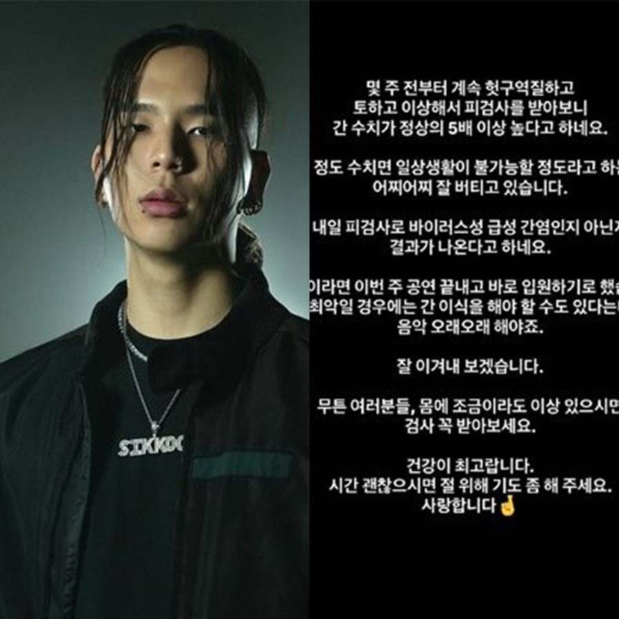 ▲ 시바. 출처| 시바 인스타그램