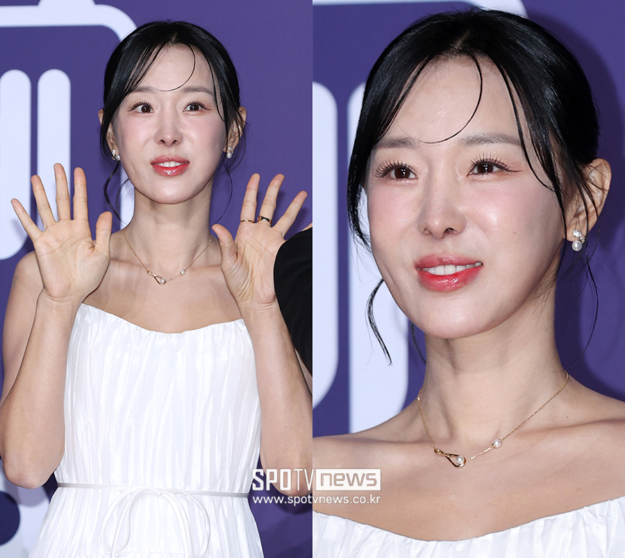 이지혜, 인중 축소 후 확 어려졌네!…몰라보게 예뻐진 비주얼 '눈길'