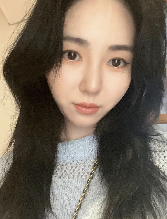 권민아, 극단적 선택 구조 후…前소속사 "악의적 비방, 심각한 정신적 피해"