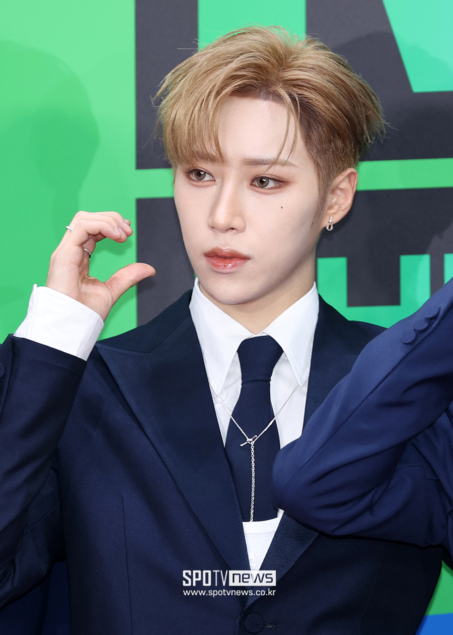 알파드라이브원 아르노, 데뷔 직전 부상…"골절 진단, 활동 유동적 참여"[전문]