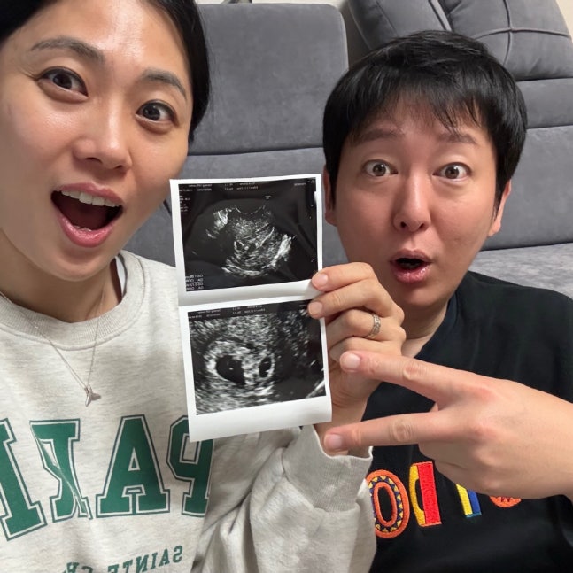 이동진♥김지연, 쌍둥이 임신 발표 "예쁜 천사들 찾아와"