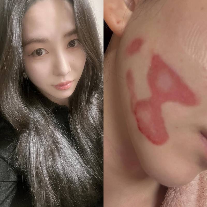 ▲ 권민아. 출처| 권민아 SNS
