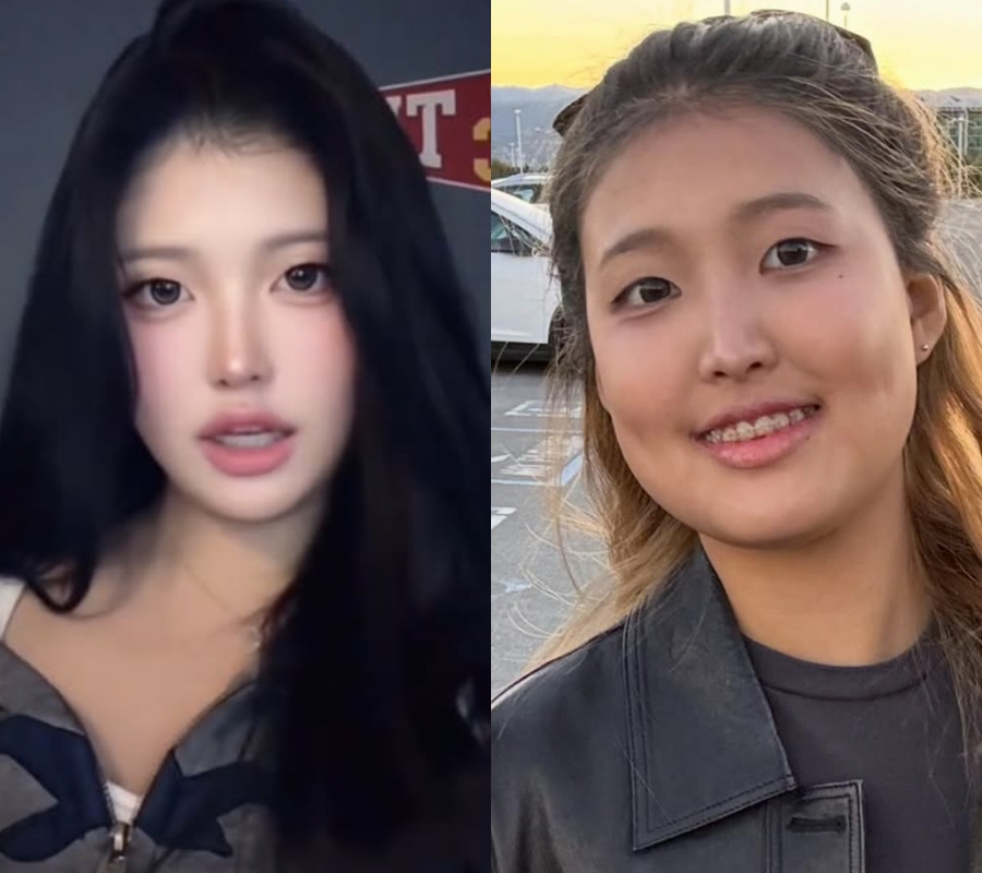 홍진경, 유학 간 16살 딸 성형 논란에 초강수…"인생 자체가 가짜" 보정 전후사진 공개