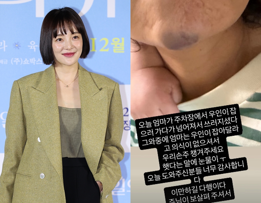 ▲ 황보라가 공개한 모친 사고 피해.  ⓒ곽혜미 기자, 황보라 인스타그램