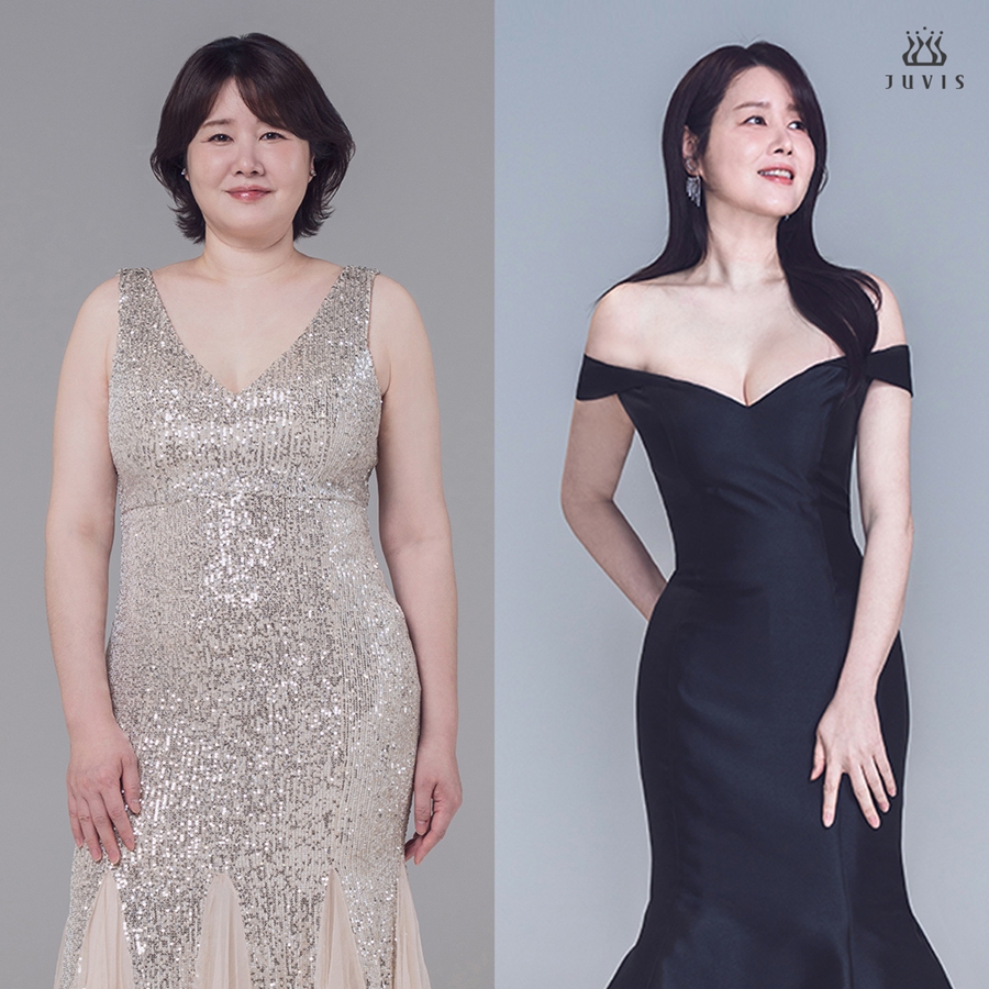 75kg→59kg…미코 眞 김지연, 되찾은 전성기 미모 "하루 버티기 어려웠는데"