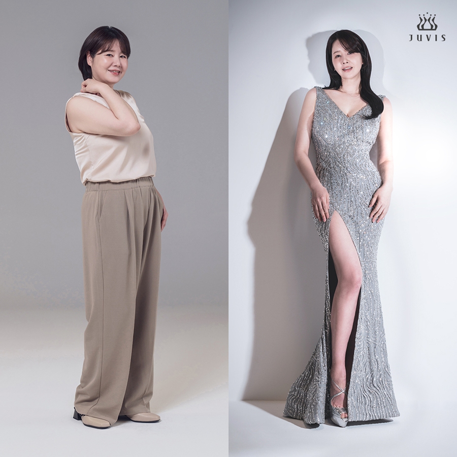 ▲ 미스코리아 출신 방송인 김지연. 제공|쥬비스다이어트
