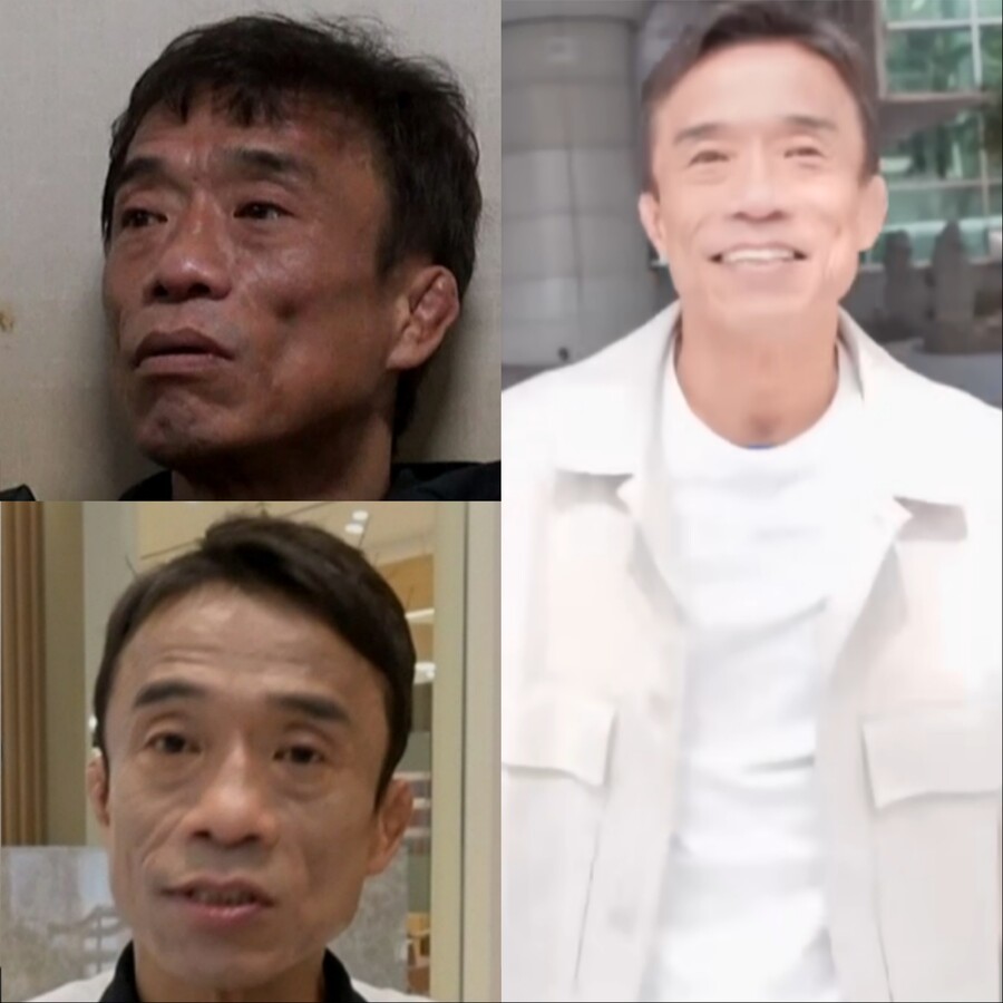▲ (왼쪽 위부터) 수술 전, 수술 2달 후, 수술 직후의 모습.출처| TV조선 '조선의 사랑꾼'
