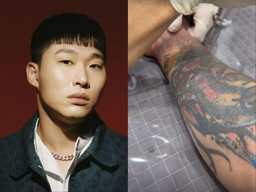 스윙스, 빅나티와 갈등 후 심경 변화 있나…타투 제거하며 "고통스러워"