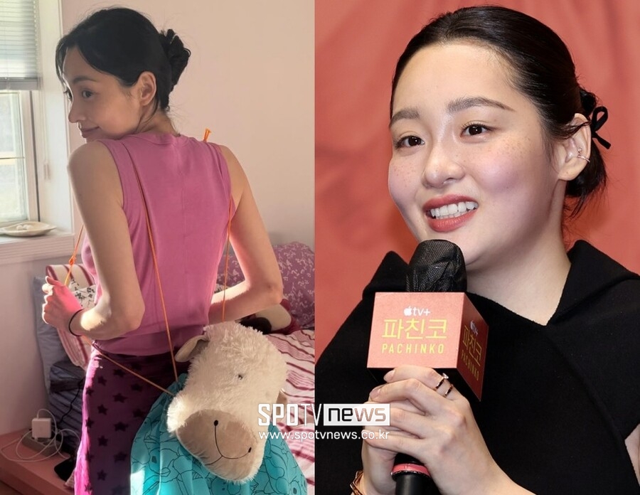 김민하까지 '뼈말라' 합류…앙상한 팔에 '위고비' 의혹까지