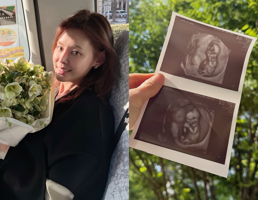 '교수♥' 구재이, 40살에 둘째 임신…"가을 딸 출산"