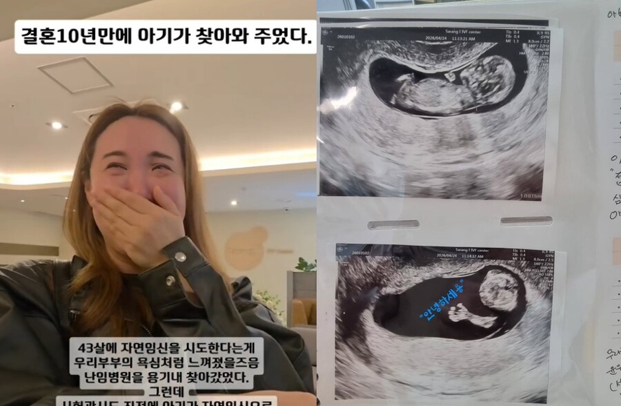 '42세' 헬스걸 이희경, 결혼 10년 만에 경사 "시험관 직전 기적처럼 자연임신"