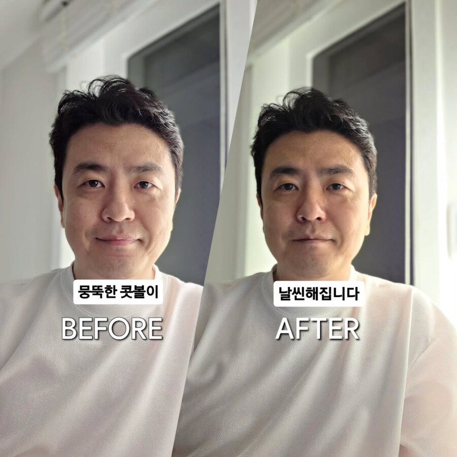 '박지윤과 이혼' 최동석, 인상 달라졌다…콧날 교정 비포&애프터 "코끝 올라가"