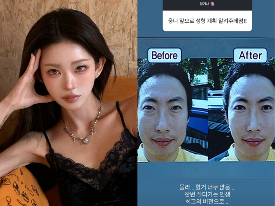 '故최진실 딸' 최준희, 신혼여행 끝나자 추가성형 예고 "인생 최고 버전으로"