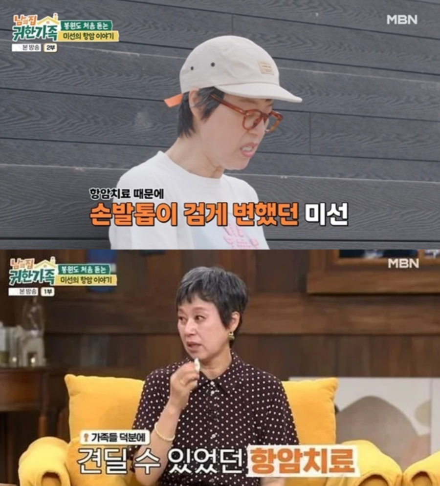 '유방암 완치' 박미선 "손발톱 까맣게 죽어"…항암 후유증 고백