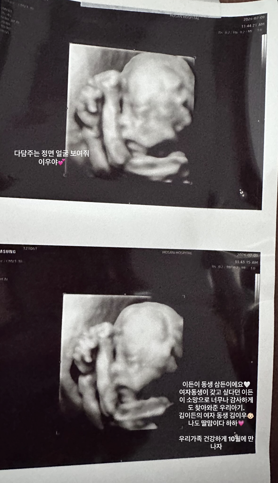 ▲ 권다미 초음파 사진. 출처| 권다미 SNS