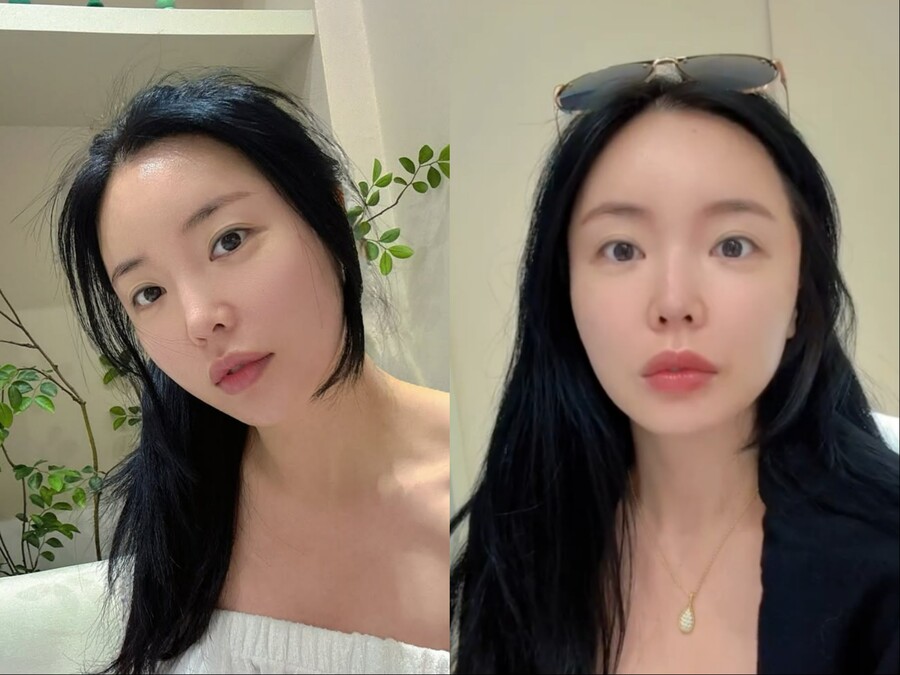 '묘하게 달라졌다'…홍진영, 비주얼 변화에 솔직 고백 "레이저 좀 쐈다"