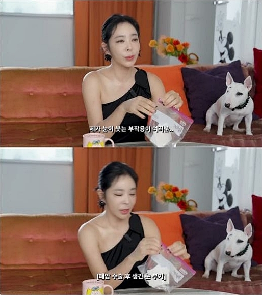 이혜영, 폐암 수술 후유증 고백 "눈 자주 부어..쌍꺼풀 테이프 붙인다"