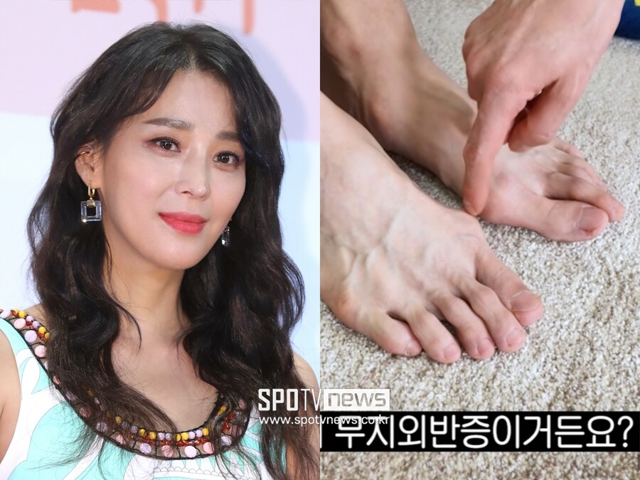 "저런 인간 발은 처음"…한고은, '7년 무직' 남편 "무지외반증 말기" 호소