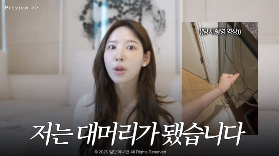 '환승연애2' 이나연, 모발이식 수술 후 탈모 부작용 "대머리가 됐다"