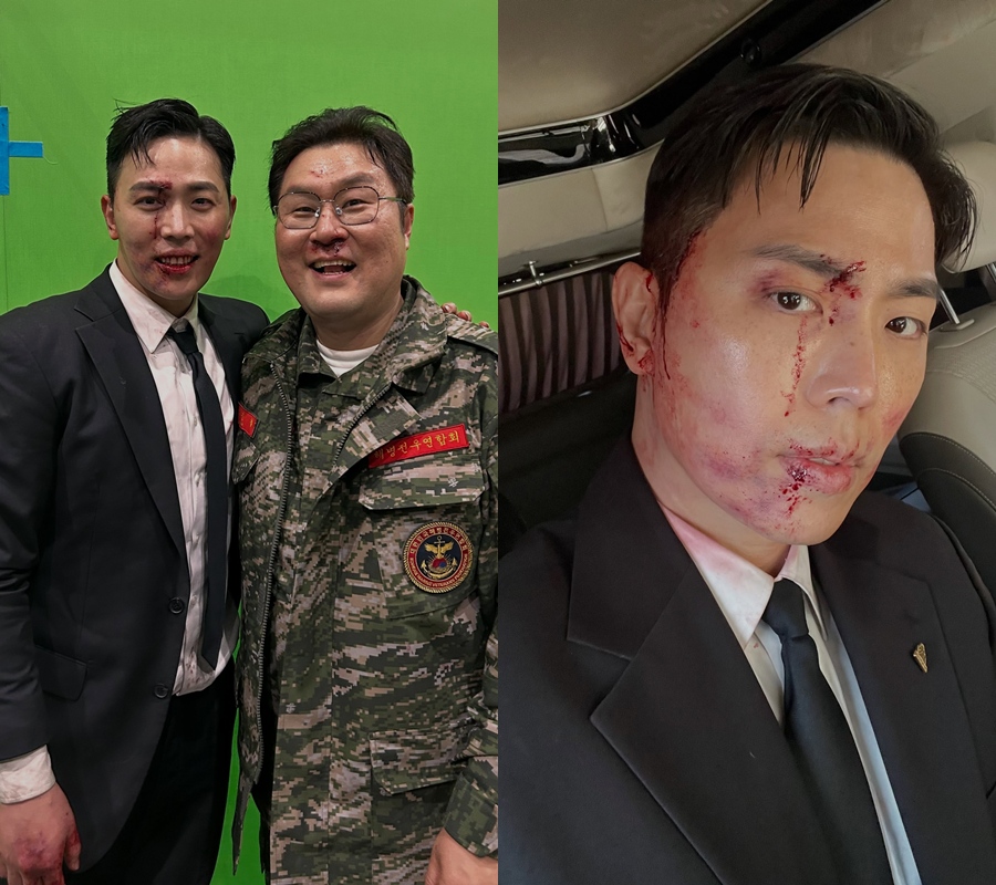 '김부장' 이동하, 윤경호와 피범벅 투샷…♥소진 달려와 "수고했어요"
