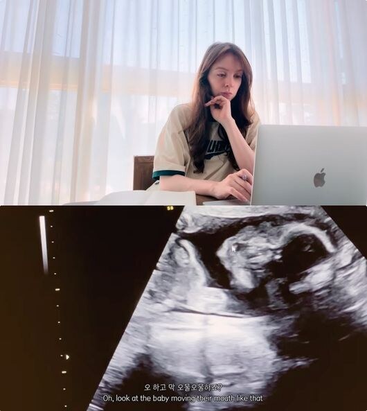 ▲ 안나. 출처ㅣ안나 유튜브 캡처