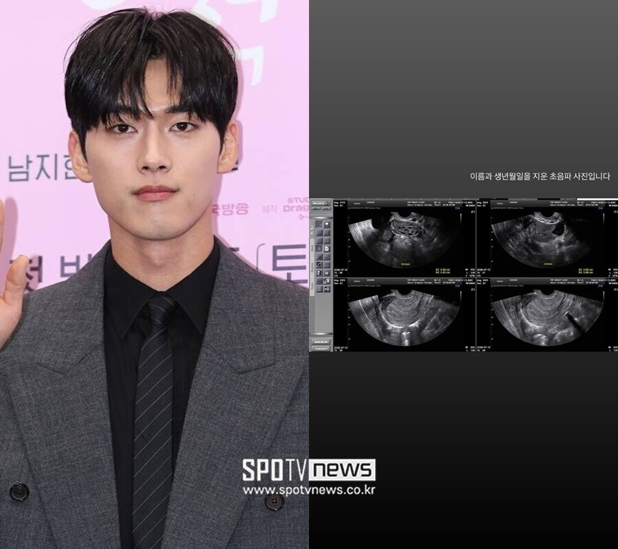 홍민기 前여친, 초음파 사진 공개로 재반박…약물수술 진료내역서