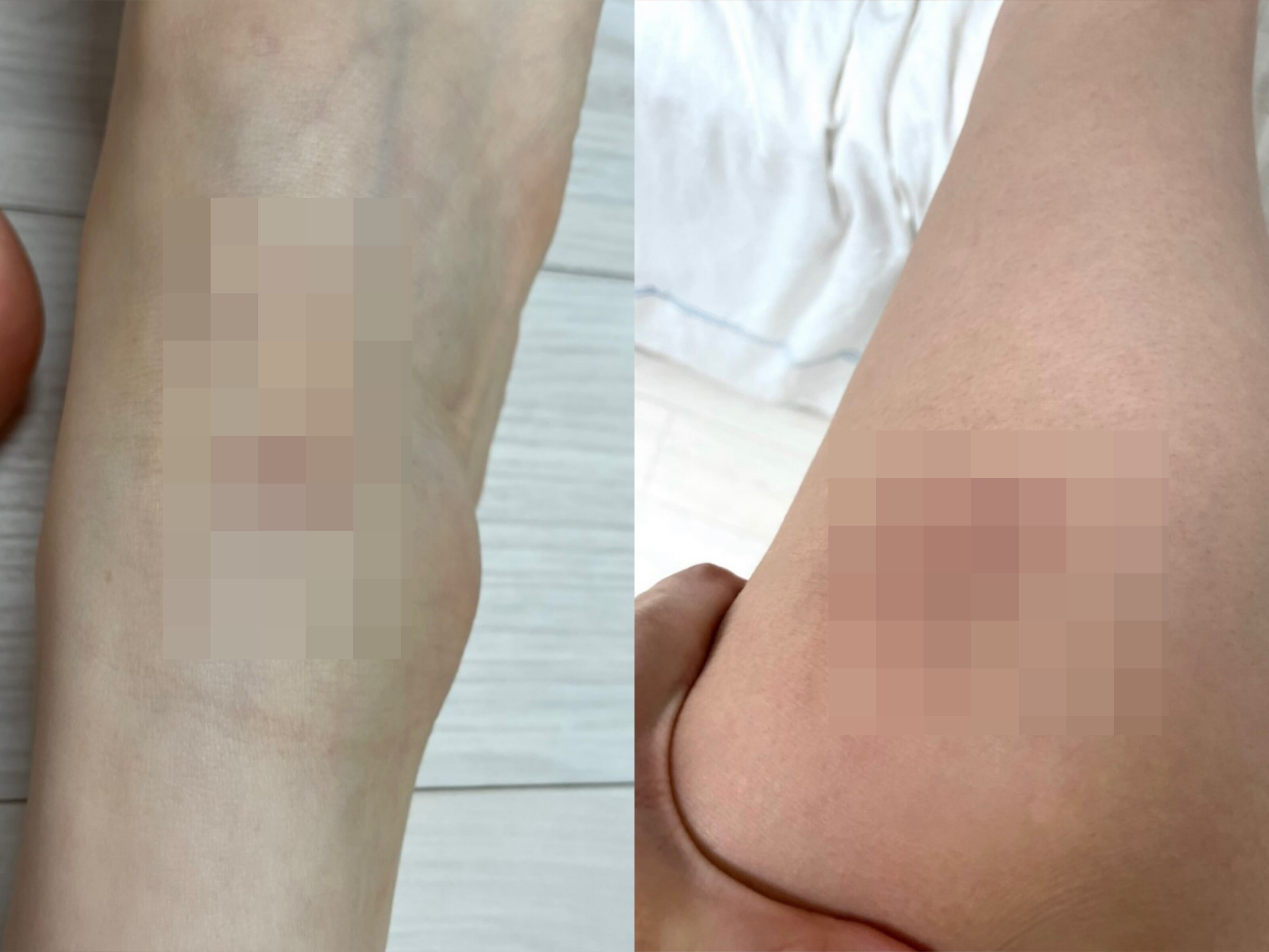 홍민기 前여친, 산부인과 진료내역→멍투성이 팔다리까지 공개 '폭로전ing'