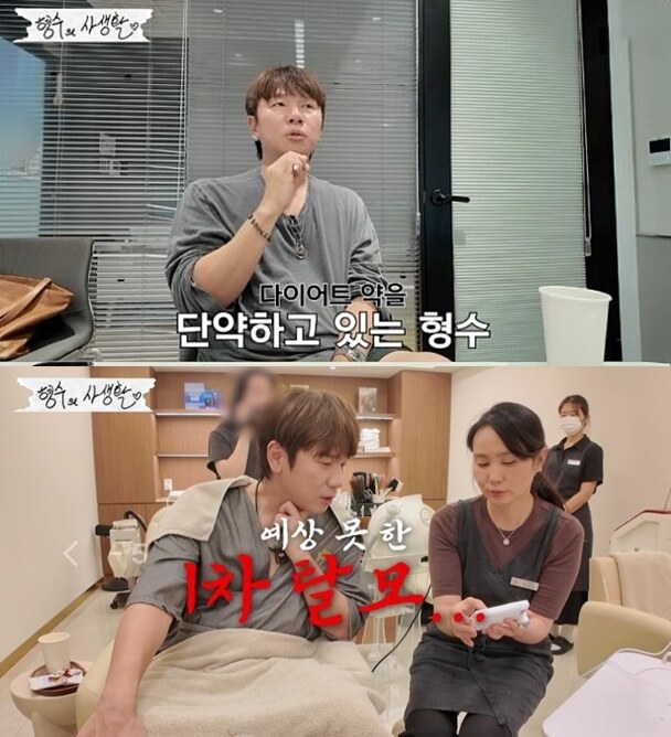 '14kg 감량' 케이윌 "탈모 진단받아 마운자로 중단" 고백('형수는 케이윌')