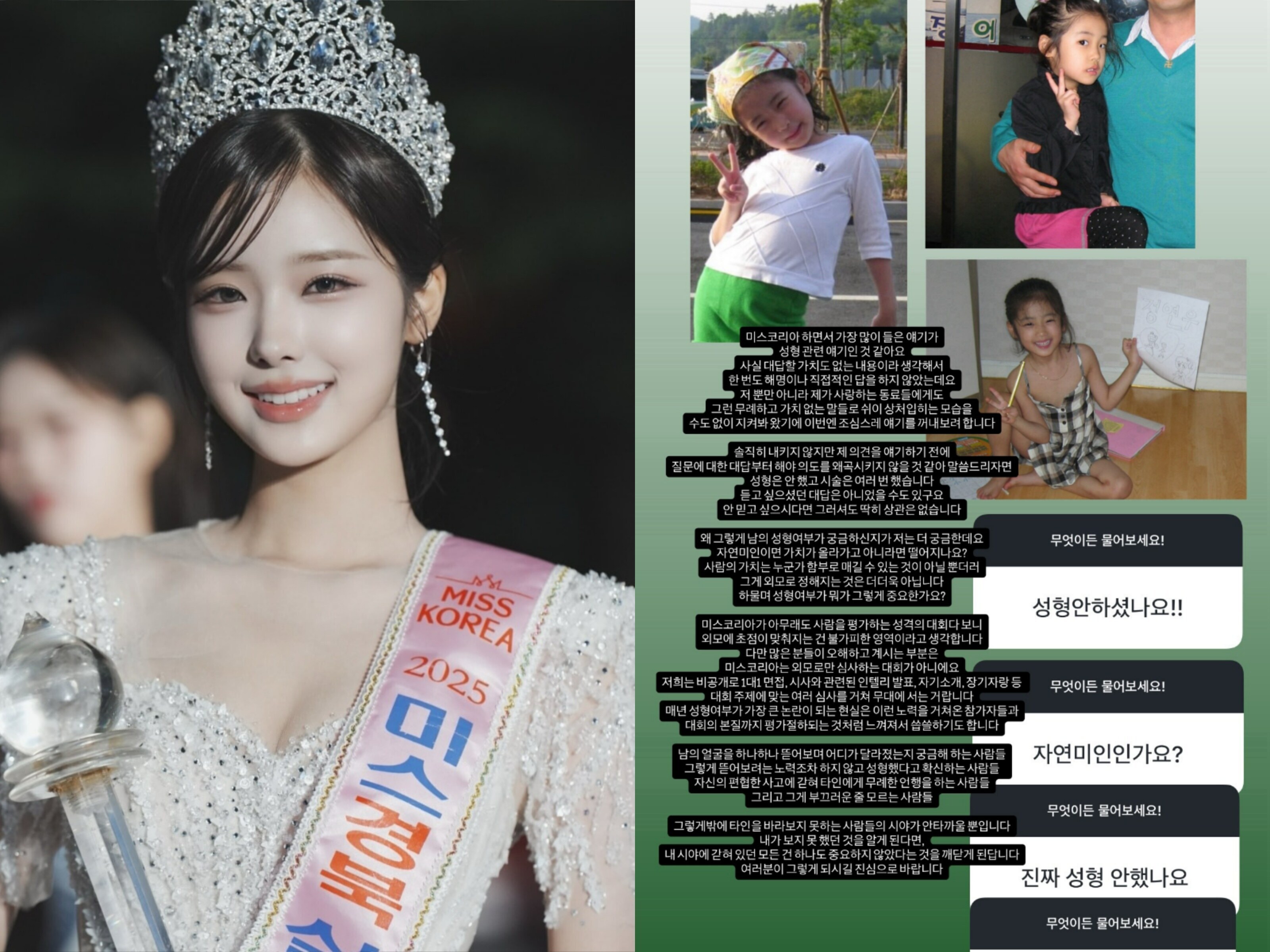 ▲ 정연우. 출처| 정연우 인스타그램