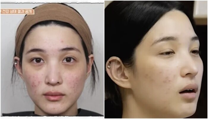 율희, 출산·육아 후 망가진 피부 '충격'..."셀카 찍기 싫었다"