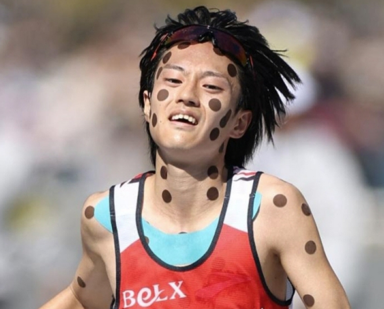 일본 마라톤에 등장한 수상한 ‘검은 동그라미’.…얼굴부터 다리까지 온몸 뒤덮은 스티커 → 환공포증 부르는데 성적은?