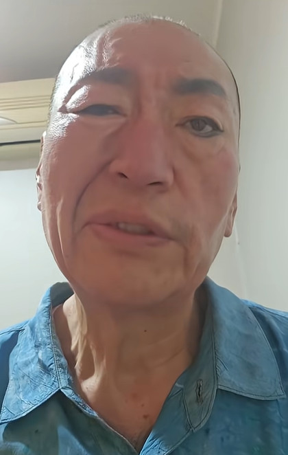 '8번 결혼' 유퉁, 안면마비로 활동 중단 발표 "눈 안 감기고 입 돌아가" 
