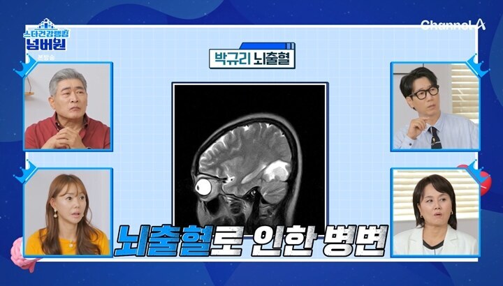 박규리 "34살에 뇌출혈, 실명하는 줄 알았다"…뇌혈관 진단 결과 "좌우 좁아져"