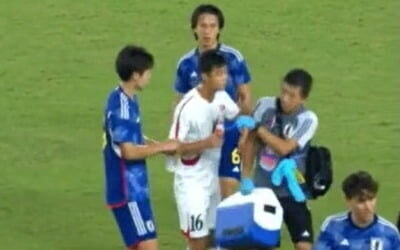 ▲ 항저우 아시안게임 일본과 북한의 남자축구 경기에서도 북한 김유성은 부상 선수 치료를 위해 그라운드에 들어온 일본 스태프에게 주먹질을 하려는 시늉을 해 논란을 빚었다. ⓒ 중계영상 캡쳐