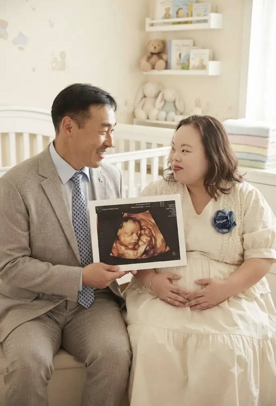 '다운증후군 작가' 서은혜, 이혼설 극복 후 임신?…초음파 사진 공개
