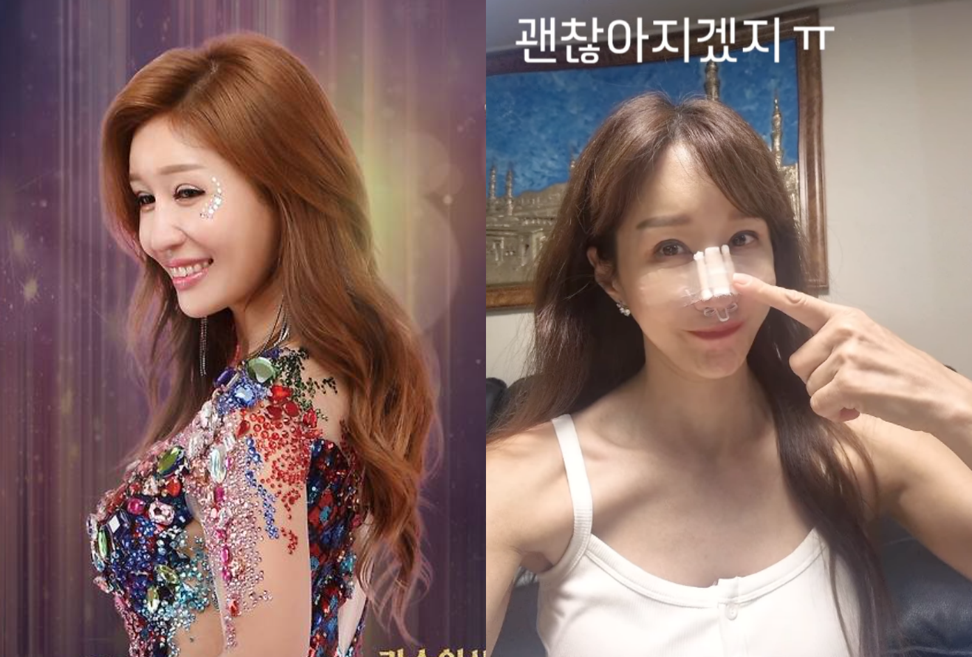 김혜연, 코 성형 부작용에 재수술→또 수술…"몸도 마음도 지쳐" 심경 토로