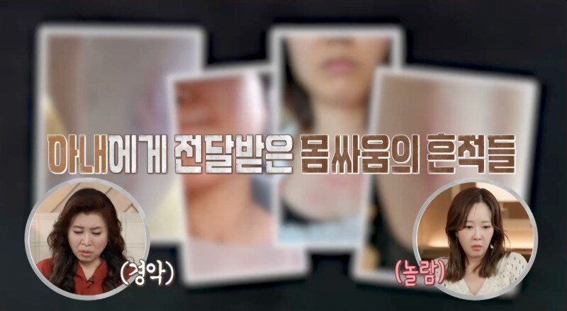 ▲ 제공| MBC '오은영 리포트-결혼 지옥'