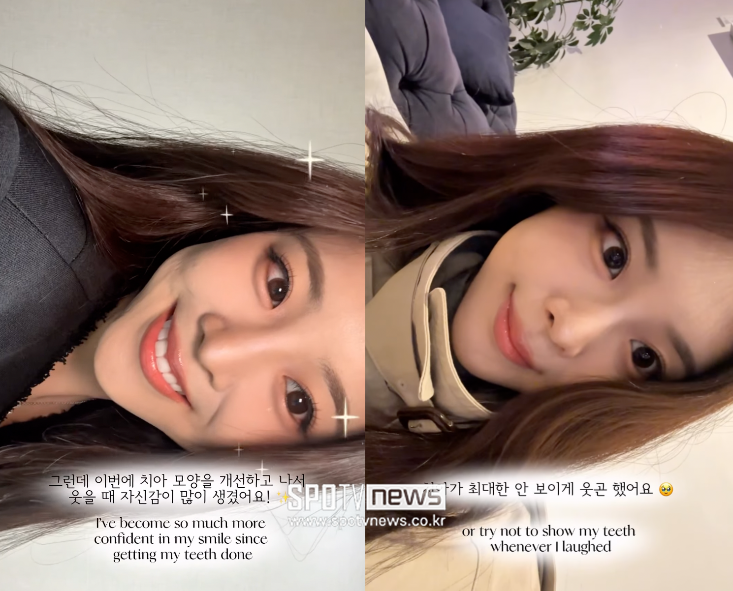 '우지원 딸' 미코 진 우서윤, 성형설 무응답→치아 시술 고백…"자신감 생겨"